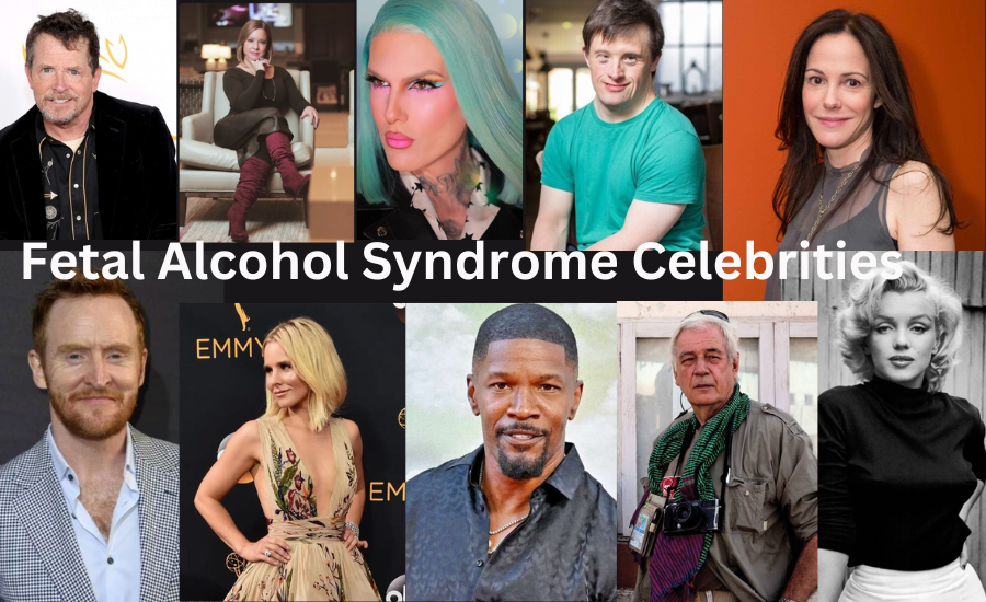 fetal alcohol syndrome celebrities